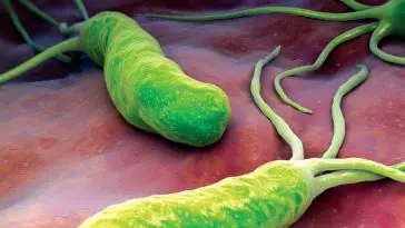 Helicobacter pylori - tout sur les bactéries insidieuses